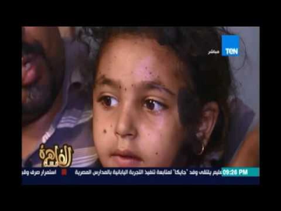 مساء القاهرة - استجابة سريعة لعلاج الطفلة نوسة...