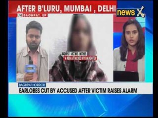 Teenager's ear chopped off for trying to resist gang rape in Baghpat, Uttar Pradesh