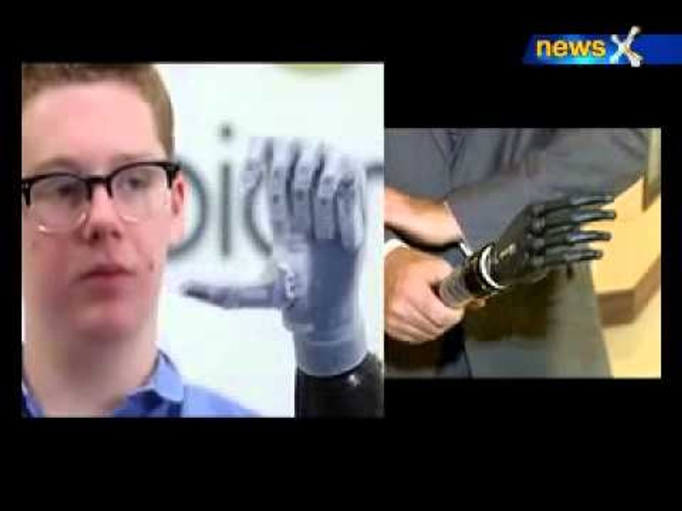 Tech and You: i Limb Technology
