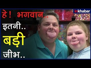 न्यू योर्क में रहने वाले बाप-बेटी के पास दुनिया की सबसे लम्बी जीभ | Longest Tongue in the World