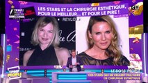 Chirurgie esthétique : ces stars qui refusent de passer sous le bistouri