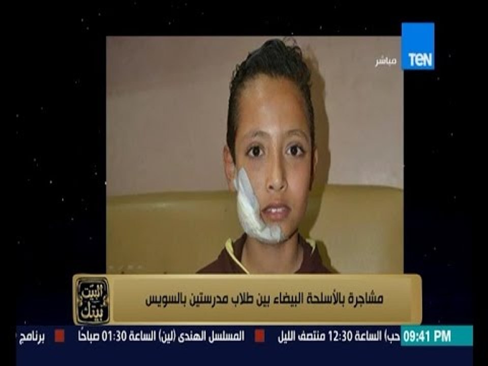 البيت بيتك - مشاجرة بالأسلحة البيضاء بين طلاب مدرستين بالسويس ومديرية التعليم بالسويس تنفى الحادث