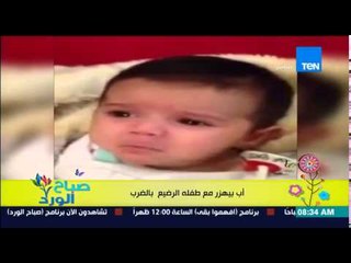 صباح الورد - فيديو لأب بيهزر مع طفل رضيع "بالضرب على الوجه" وشاهد رد فعل الطفل