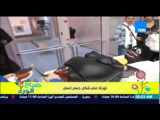 صباح الورد - فيديو لأغرب تورتة فى العالم على شكل جسم إنسان وتبكي عند تقطيع جزء منها