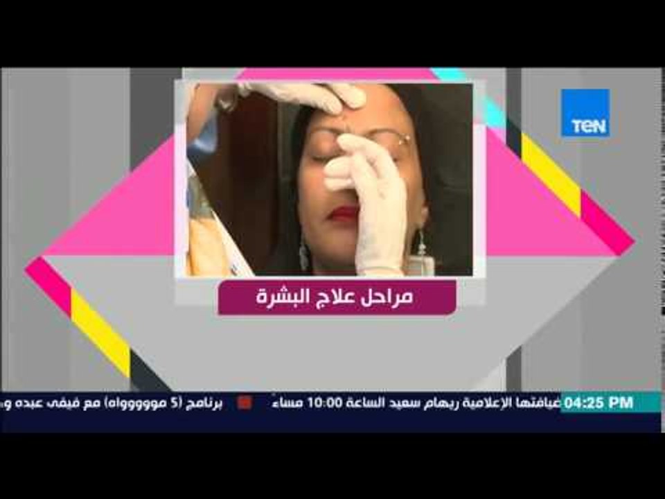 قمر 14 - د/طاهرة لهيطة تكشف كواليس علاج بشرة نيسان بطلة الـ makeover وتغير الأنف بدون أى جرحة