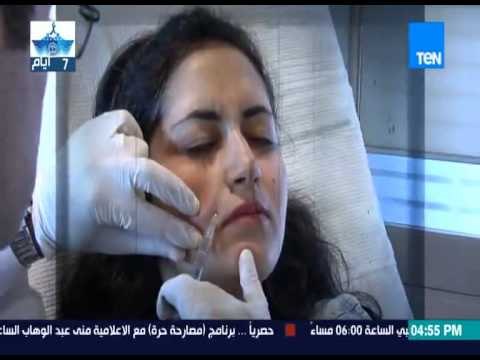 قمر 14 - أول جلسة لأية نيازي مع د.هيثم رزق إستشاري الأمراض الجلدية وتجميل الجلد لمعالجة البشرة