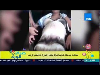 صباح الورد - لقطات مذهلة تجذب الكثير من المشاهدات لبطن إمرأة حامل تتحرك كأفلام الرعب