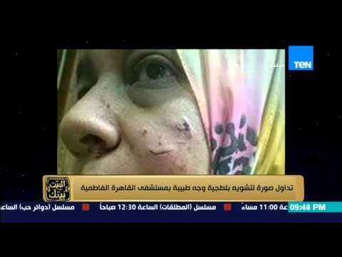 البيت بيتك | El Beit Beitak - تداول صورة لتشوية بلطجية وجه طبيبة بمستشفى القاهرة الفاطمية
