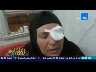 مساء القاهرة - بعد حقنهم بالعين واصابتهم بالعمى يحكون تفاصيل دخول المستشفى وحقنهم بعقار محظور