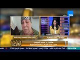 مساء القاهرة - طبيب علاج الاورام بجامعة المنصورة : هذه المادة محظورة بالحقن بالعين !