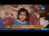 استجابة لمناشدة مساء القاهرة ..المتحدث باسم الصحة الثلاثاء لجنة لعلاج 