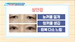 [HEALTH] Questions about eyelid surgery for swollen eyes!,기분 좋은 날20190508