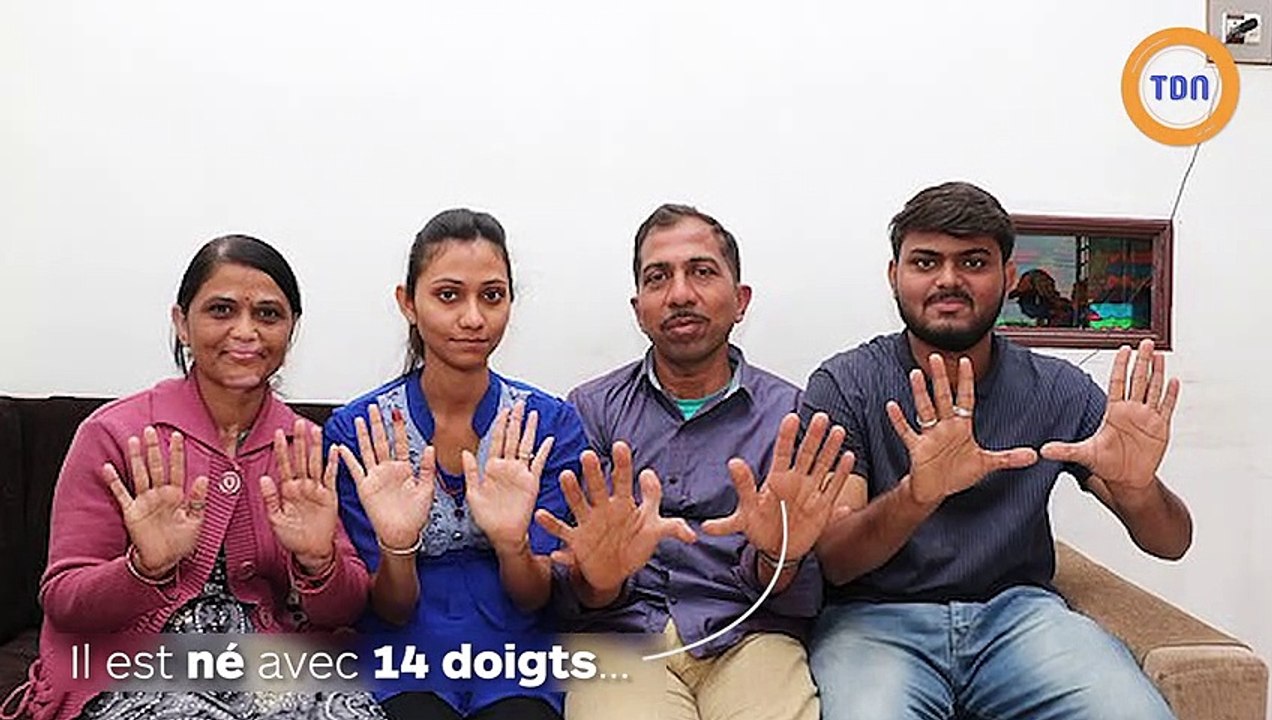 14 doigts, 14 orteils : l’homme aux plus de doigts au monde a toujours peur de se les couper !