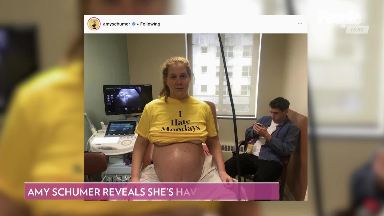 It'll Be a Boy for Amy Schumer and Husband Chris Fischer