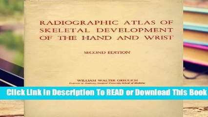 [Read] Radiographic Atlas of Skeletal Development of the Hand and Wrist  For Kindle