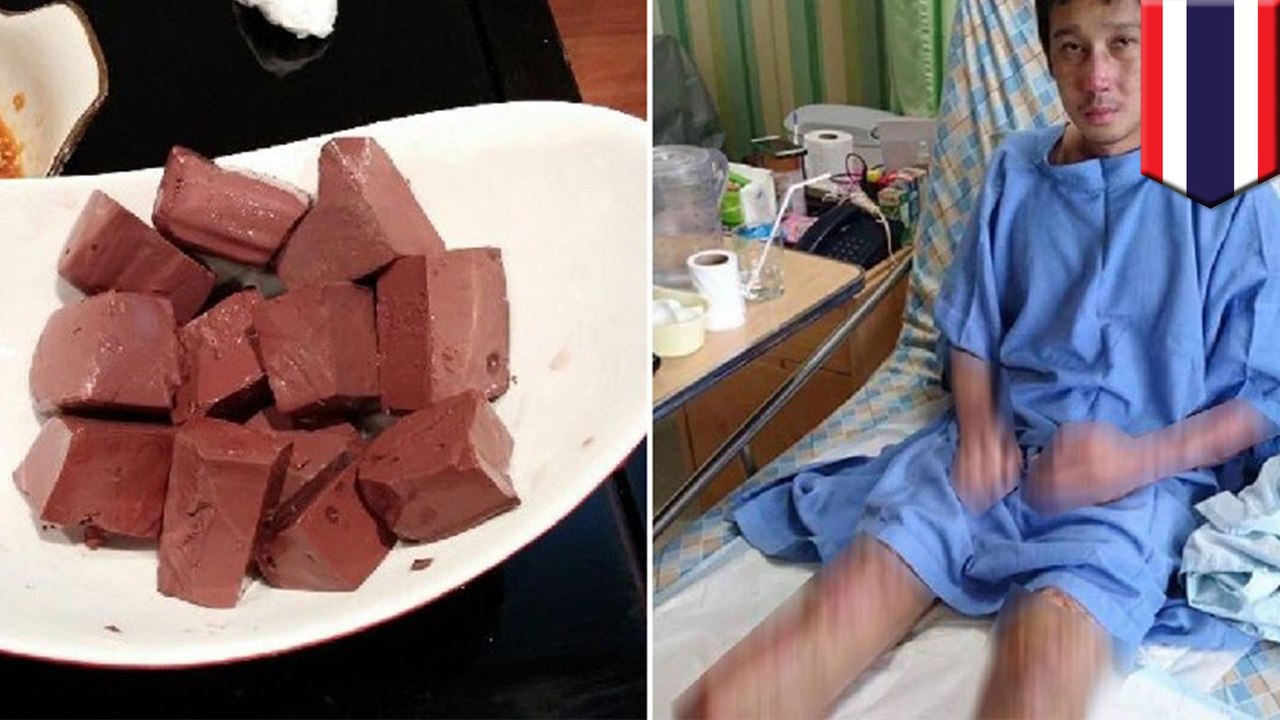 ブタの血を食べた男性 豚レンサ球菌に感染し両足を切断 - トモニュース