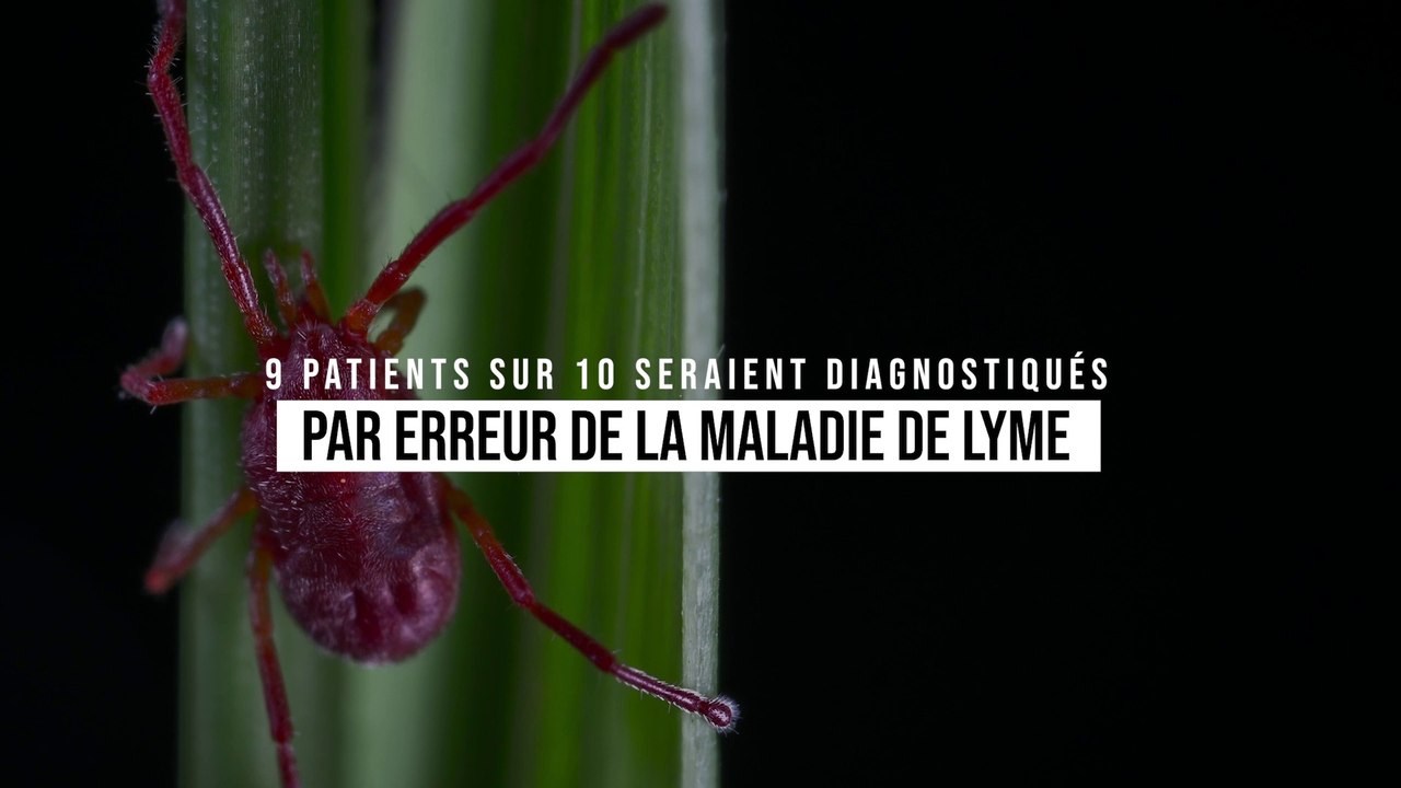 9 patients sur 10 seraient diagnostiqués par erreur de la maladie de Lyme