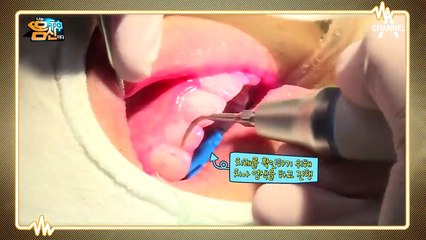 입속 세균 타파 솔루션 Step1! 스케일링 하라!