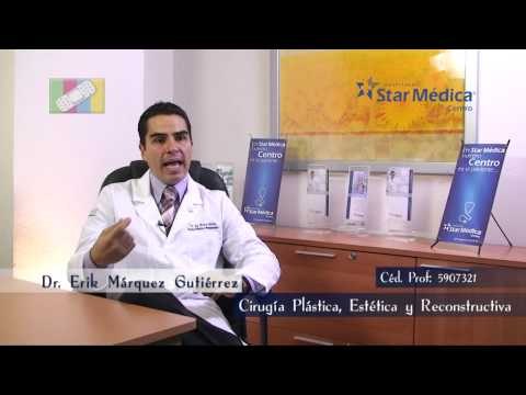 ¿Qué se debe tomar en cuanta antes de realizar una liposucción?