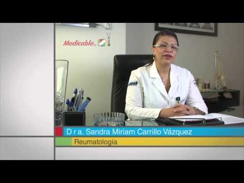 ¿A quién afecta la artritis reumatoide?