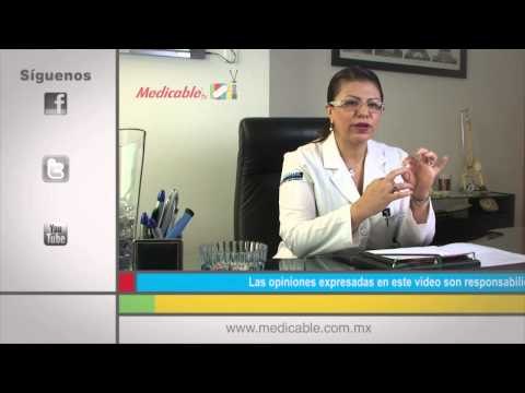 ¿Cuáles son los síntomas más comunes de la artrosis?