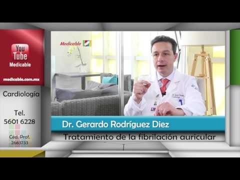¿Cómo se trata la fibrilación auricular?