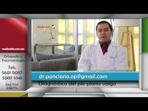 ¿Cómo se diagnostica el pie plano valgo?