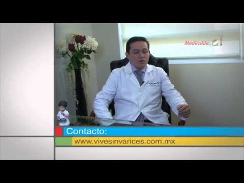 Actualmente, ¿qué otras opciones de cirugía existen para el tratamiento de las varices?