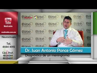 ¿Cómo se diagnostica un meningioma?