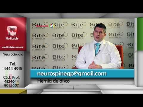 ¿En qué parte de la columna se presentan las hernias de disco?