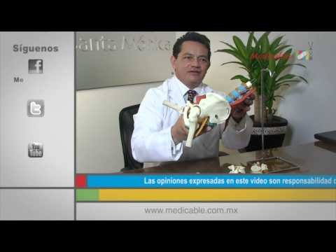 ¿Cómo puedo prevenir el dolor de ciática?