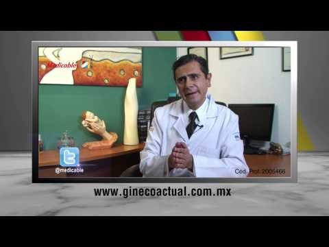 ¿Cuántos tipos de menstruación hay?