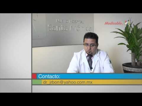 ¿El desgaste de las articulaciones a qué edad inicia?