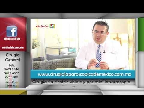 001 QUE ES LA CIRUGIA SIN CICATRIZ VISIBLE Y POR MINI LAPAROSCOPIA