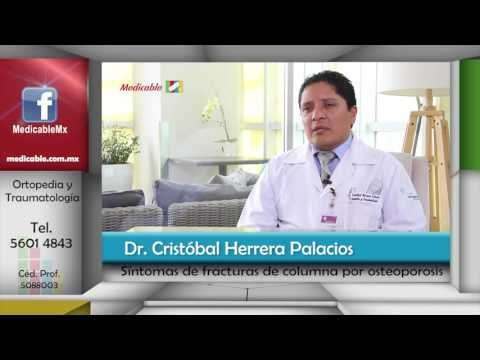 002 CUALES SON LOS ISNTOMAS DE LAS FRACTURAS DE LA COLUMNA POR OSTEOPOROSIS