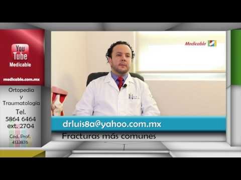 001 CUALES SON LAS FRACTURAS MAS COMUNES
