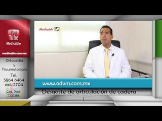 014 CUAL ES LA FUNCION DE UN REMPLAZO ARTICULAR