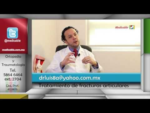 010 SE PUEDE REGENERAR EL CARTILAGO ARTICULAR DESPUES DE UNA FRACTURA
