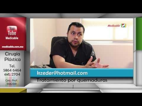 ¿Se pueden tratar las cicatrices por quemadura con cirugía plástica aunque ya sean de tiempo atrás?