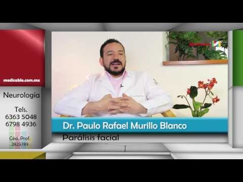 ¿Cuál es el riesgo de no atender una parálisis facial?