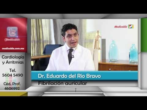¿Cuáles son las causas de la fibrilación auricular?