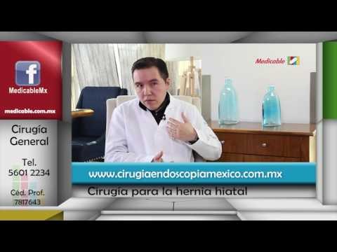 ¿Cuándo es necesaria una cirugía para el tratamiento de la hernia hiatal?