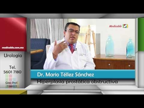 ¿Cuáles son las opciones de tratamiento para la hiperplasia prostática obstructiva?