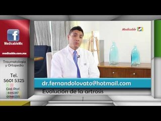 ¿Cómo evoluciona la artrosis?