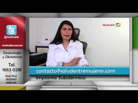 ¿Es sencilla la colocación del implante subdérmico?