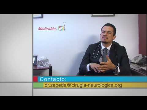 Sin tener síntomas o dolores de cabeza, ¿es recomendable hacer exámenes del cerebro?