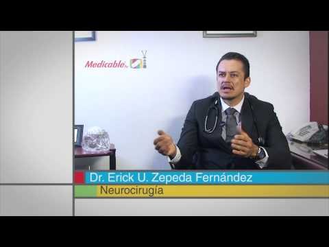 ¿Cuál es la forma adecuada de tratar un Astrocitoma?