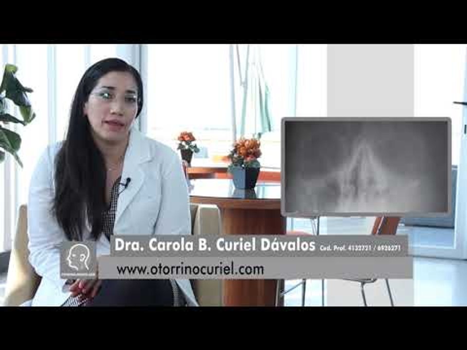FRACTURA NASAL. Causas y tratamiento