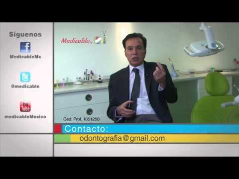 ¿Cómo es el procedimiento de extracción de las células madre dentales?