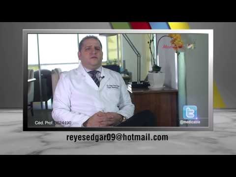 ¿Cuáles son los tipos de cirugía por los que se puede realizar una apendicectomía?